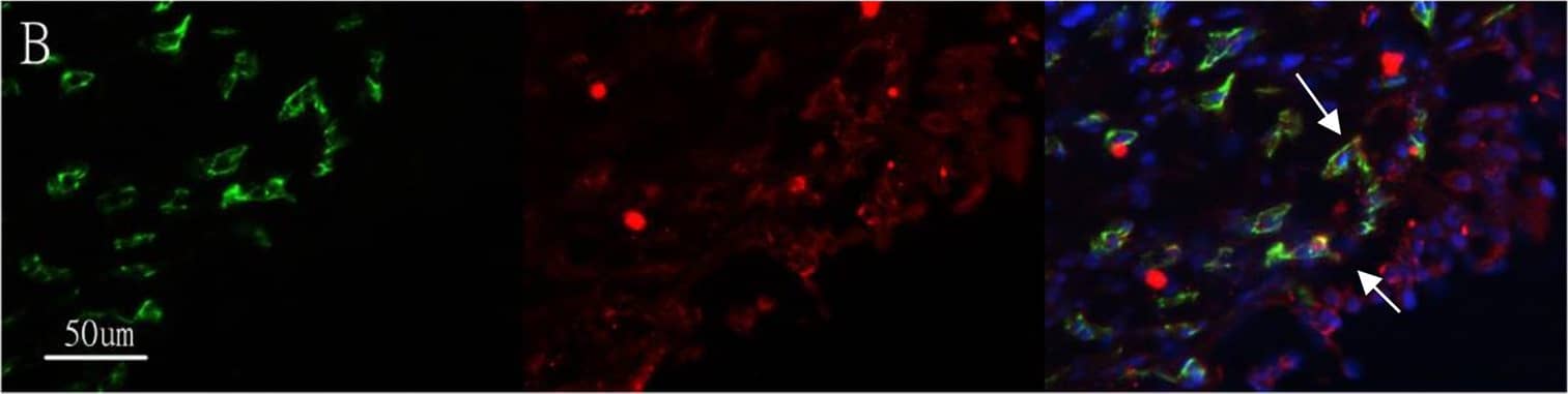 CD31/PECAM-1 Antibody (JC/70A) - BSA Free