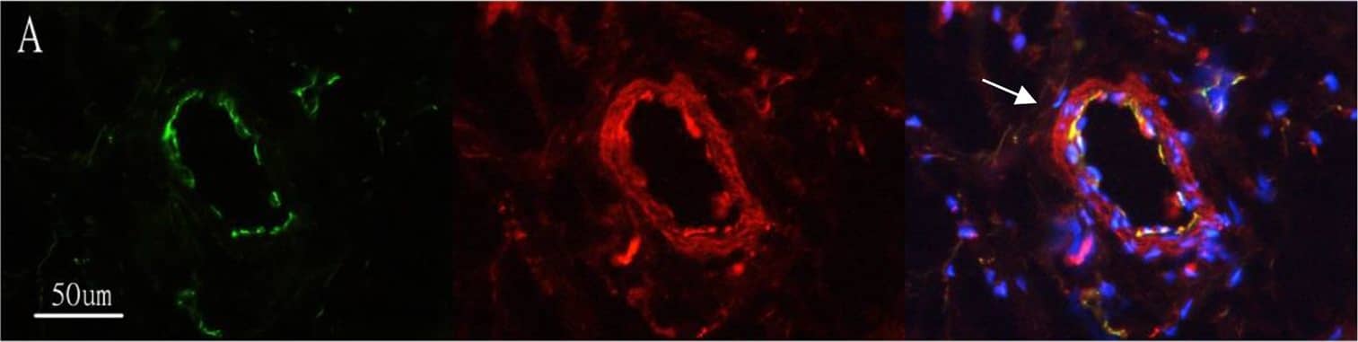 CD31/PECAM-1 Antibody (JC/70A) - BSA Free