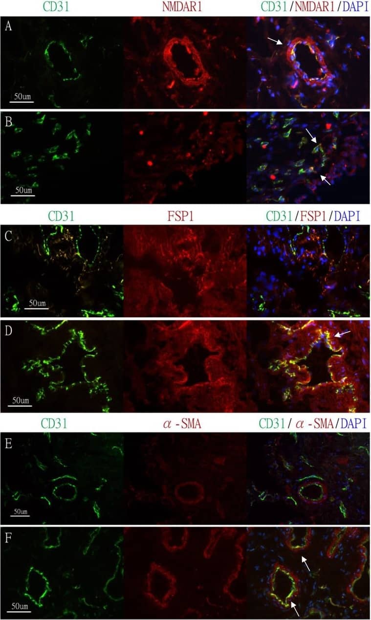 CD31/PECAM-1 Antibody (JC/70A) - BSA Free
