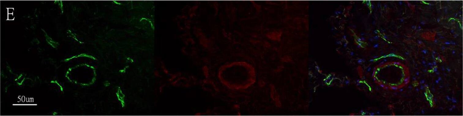 CD31/PECAM-1 Antibody (JC/70A) - BSA Free