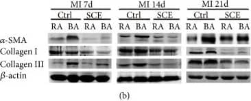 Collagen III alpha 1/COL3A1 Antibody