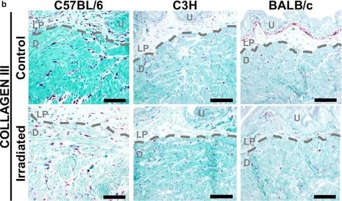 Collagen III alpha 1/COL3A1 Antibody