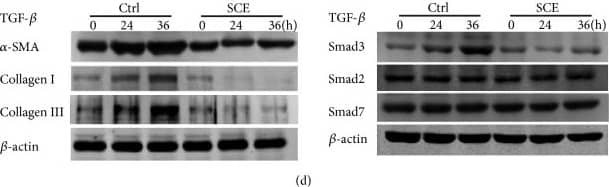 Collagen III alpha 1/COL3A1 Antibody