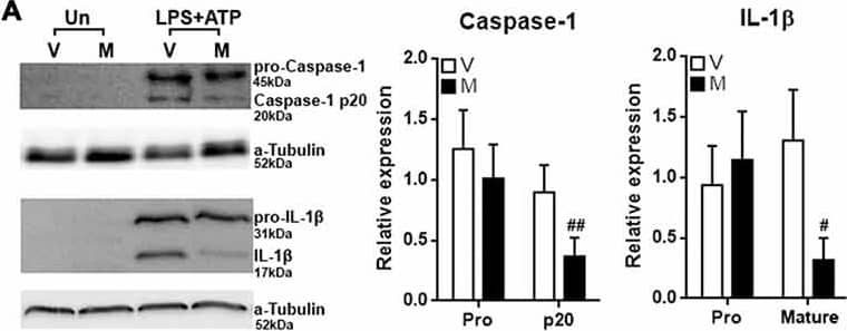 IL-1 beta/IL-1F2 Antibody