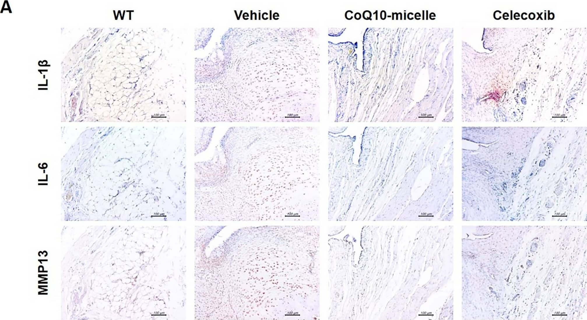 IL-1 beta/IL-1F2 Antibody - Azide and BSA Free