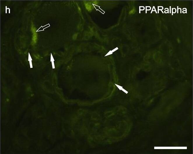 PPAR alpha/NR1C1 Antibody - N-terminal