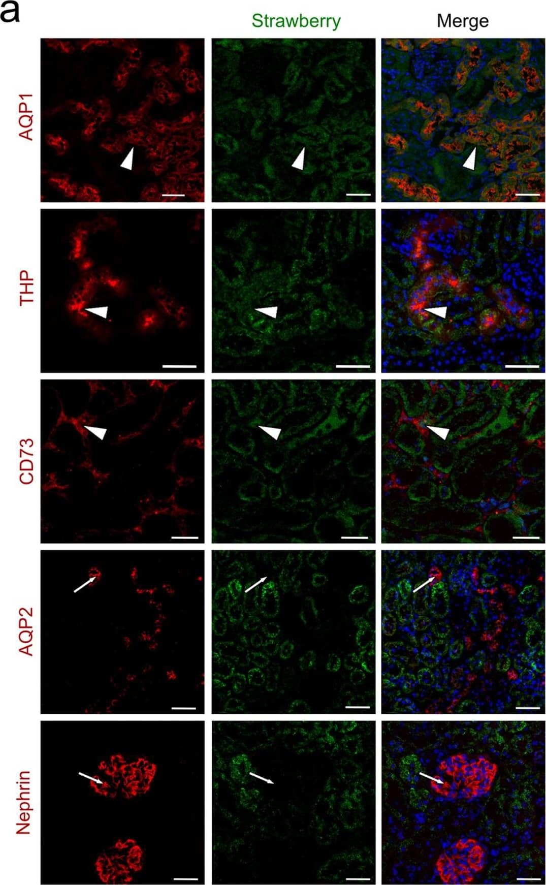 Aquaporin 1/AQP1 Antibody (1/A5F6)