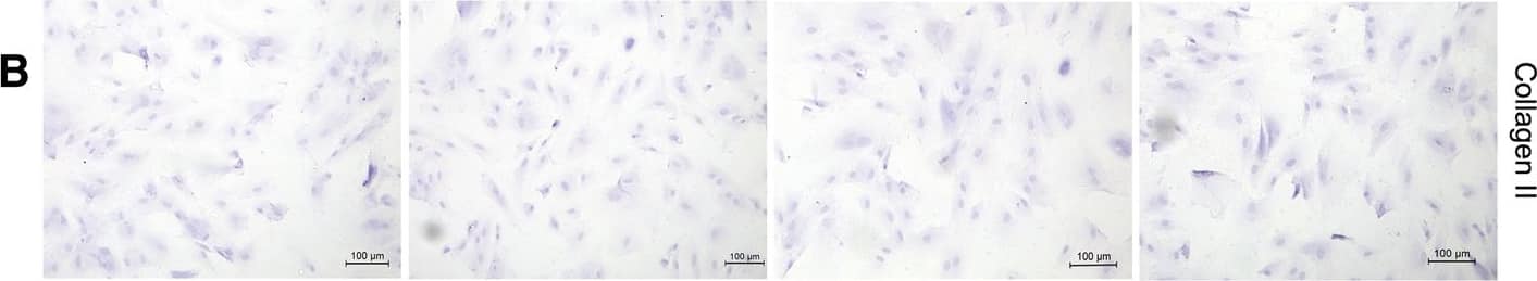 Collagen II Antibody (5B2.5) - BSA Free