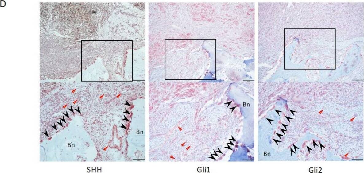 GLI-2 Antibody - BSA Free