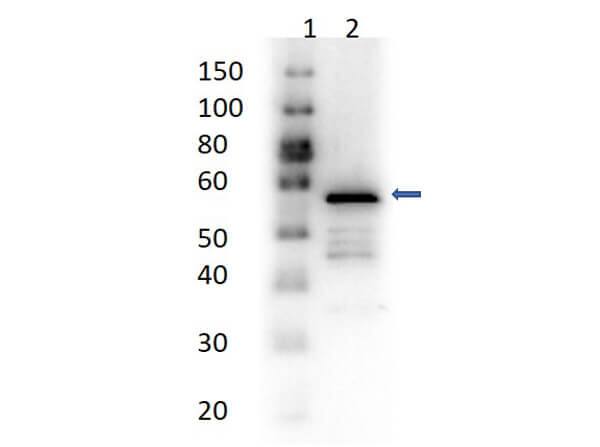Aldehyde Dehydrogenase 1-A1/ALDH1A1 Antibody