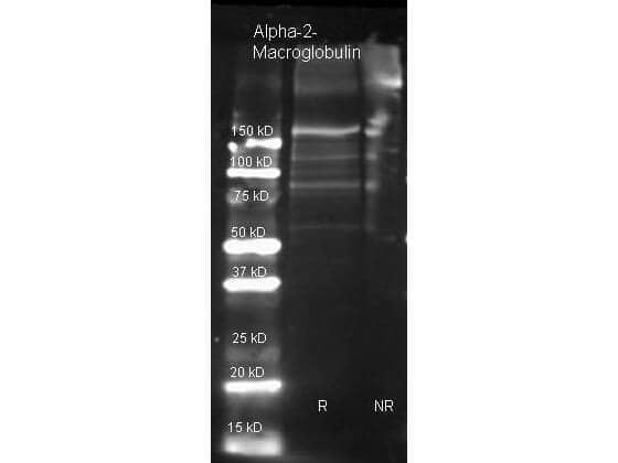 alpha 2-Macroglobulin Antibody [Biotin]