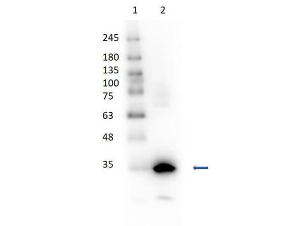 Carbonic Anhydrase I/CA1 Antibody [HRP]