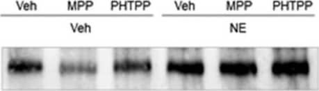 beta-1 Adrenergic R/ADRB1 Antibody