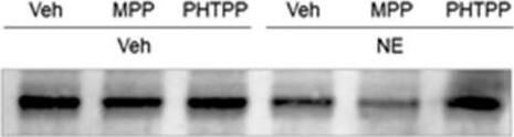 beta-1 Adrenergic R/ADRB1 Antibody