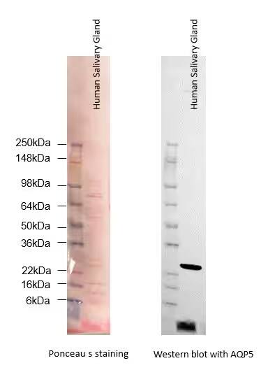 Human Salivary Gland Whole Tissue Lysate (Adult Whole Normal)