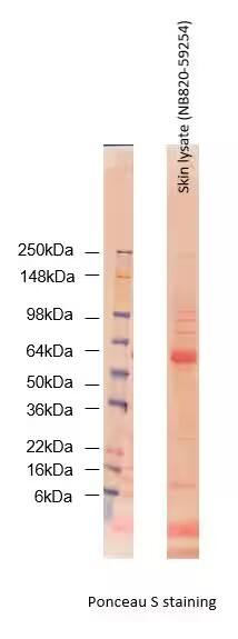 Human Skin Whole Tissue Lysate (Adult Whole Normal)