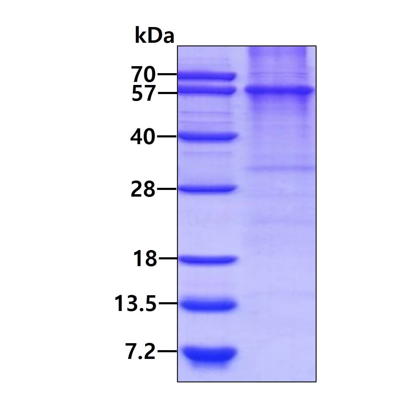 Recombinant Human Syntaphilin His Protein