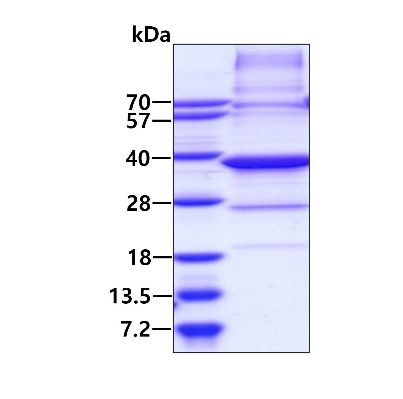 Recombinant Human Geminin His Protein SDS-Page: Recombinant Human Geminin Protein [NBC1-18423]