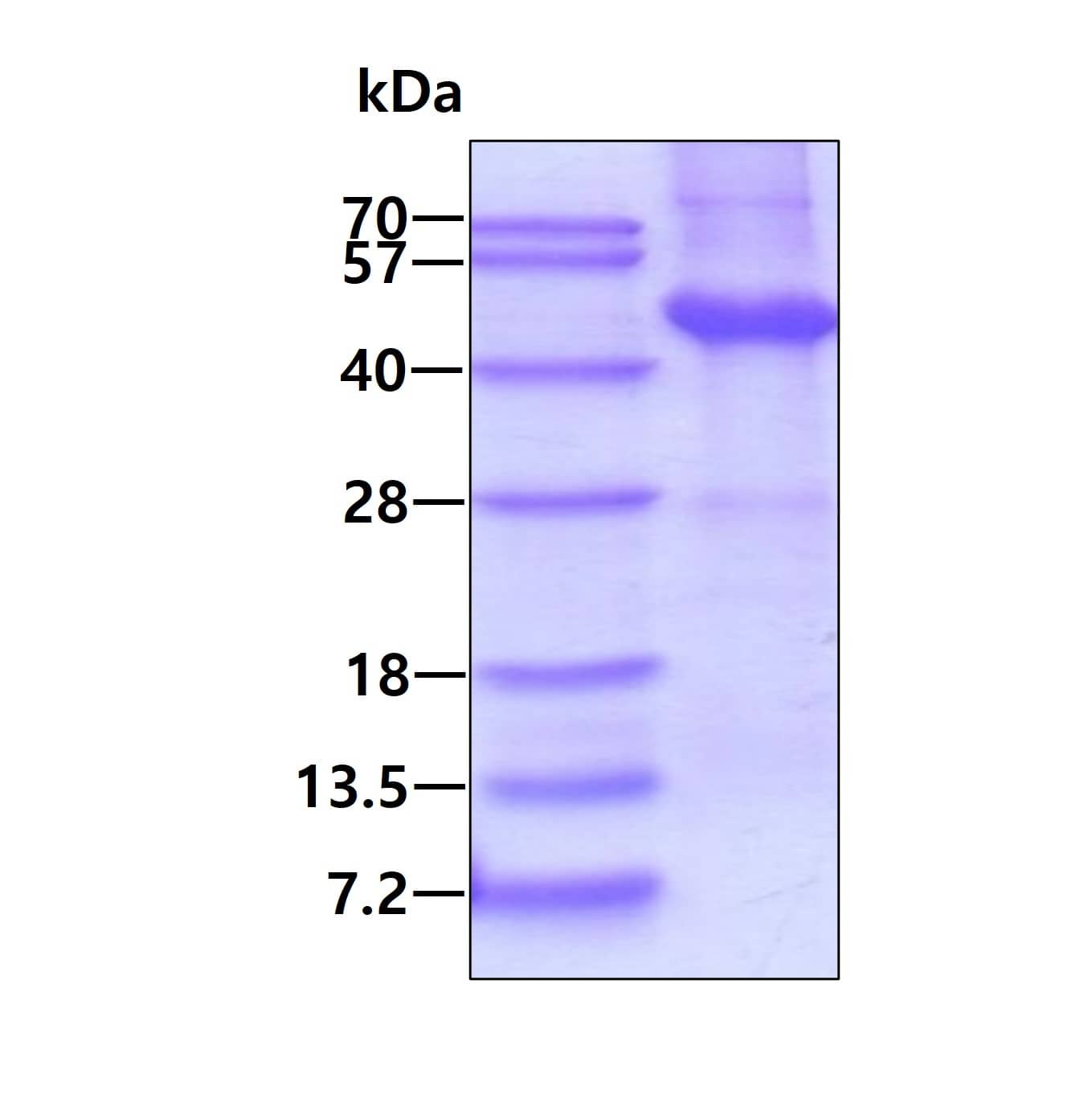 Recombinant Human Dysbindin His Protein