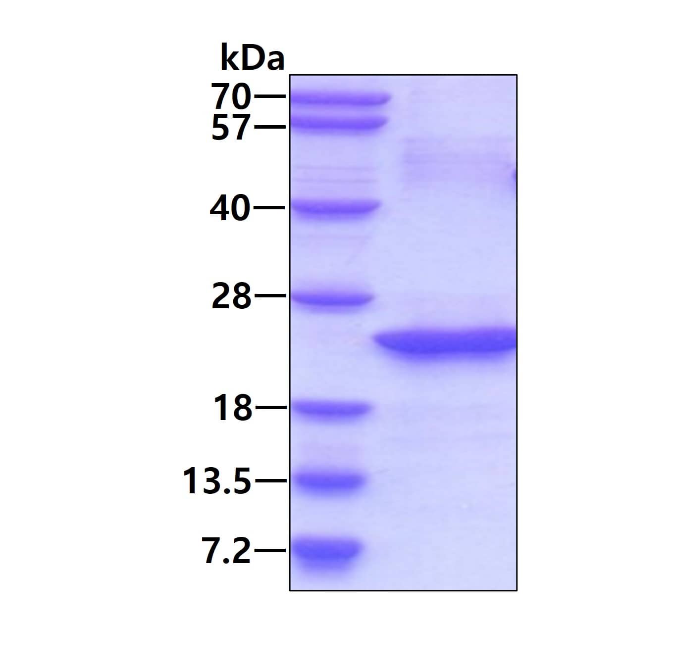 Recombinant Human IL-32 His Protein SDS-Page: IL32 Protein [NBC1-25853]