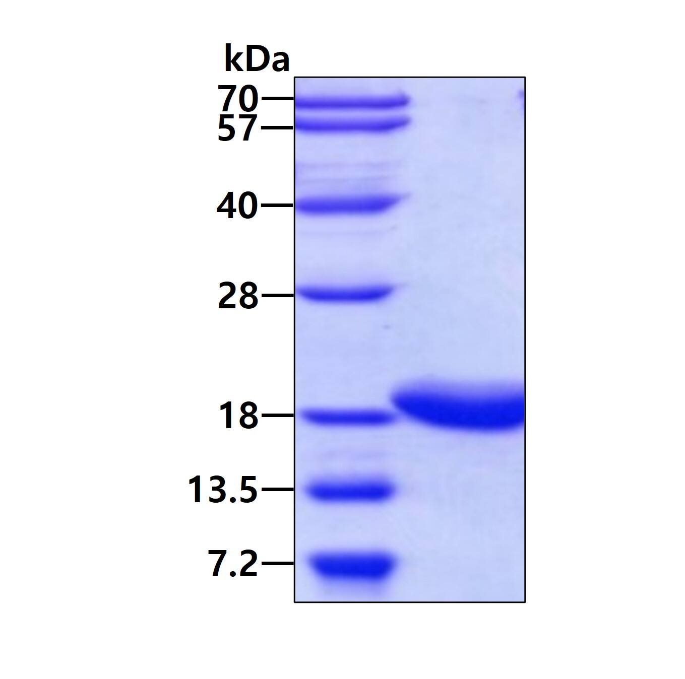 Recombinant Human TNNC2 Protein
