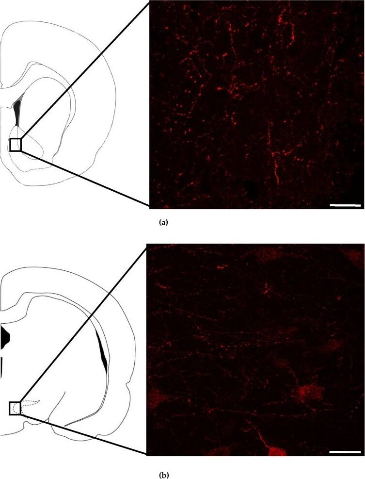 Neuromedin UR2/NMUR2 Antibody - BSA Free