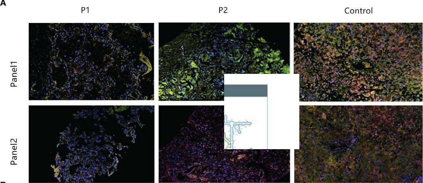 IFN-alpha 1 Antibody
