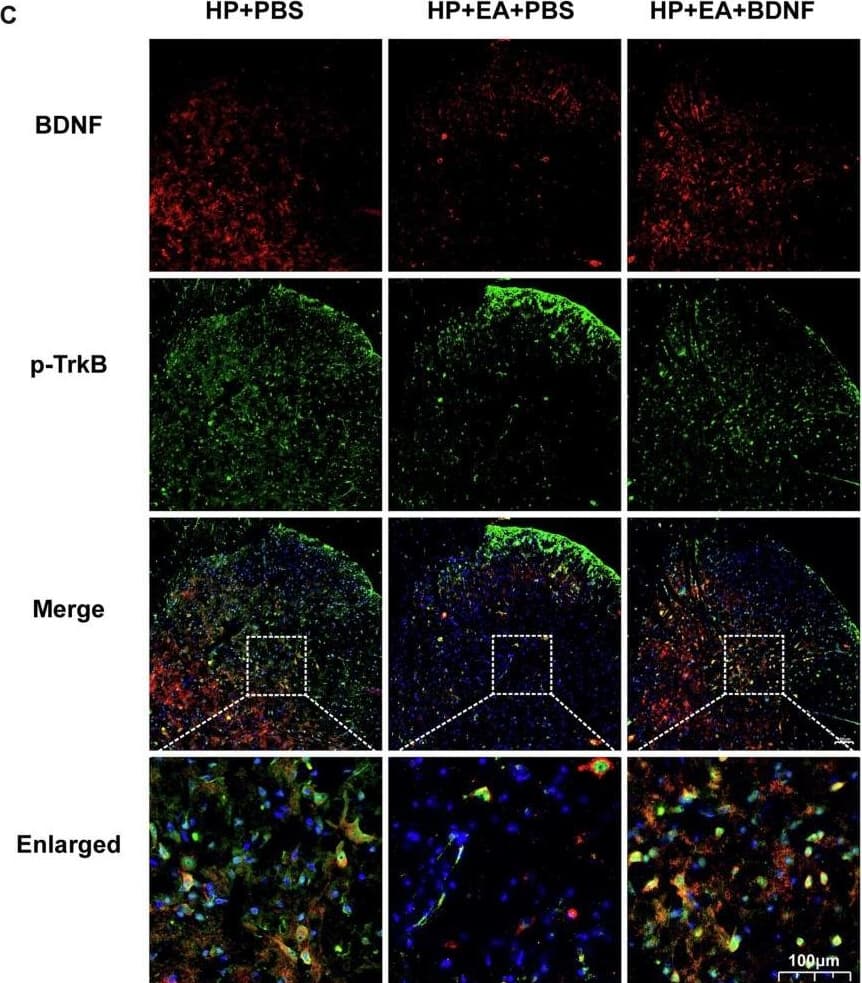 TrkB [p Tyr816] Antibody - Azide and BSA Free