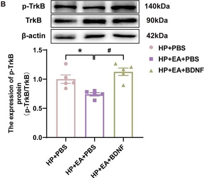 TrkB [p Tyr816] Antibody - Azide and BSA Free