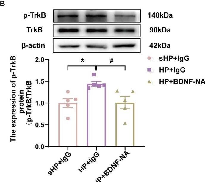 TrkB [p Tyr816] Antibody - Azide and BSA Free