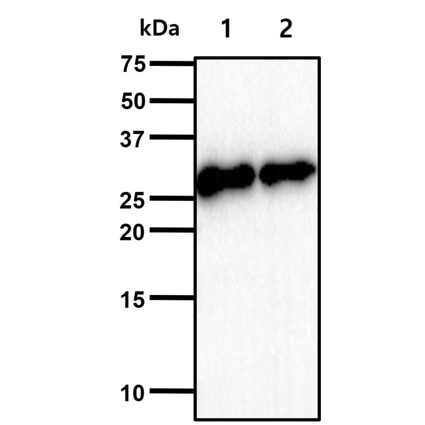 AK3 Antibody (SJB3-36) - BSA Free Western Blot: AK3 Antibody (SJB3-36) [NBP1-04261]