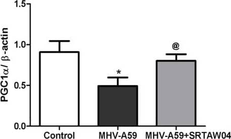 PGC1 alpha Antibody - BSA Free