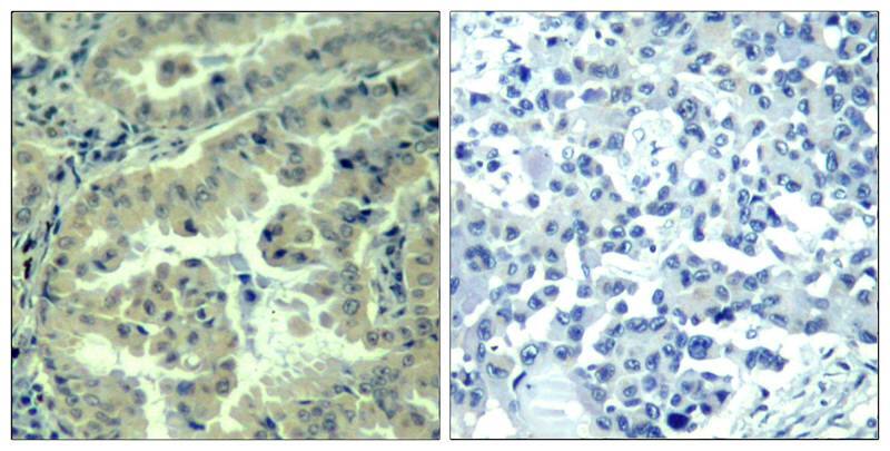 eIF4G1 [p Ser1231] Antibody - BSA Free