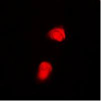 Smad2 [p Thr220] Antibody