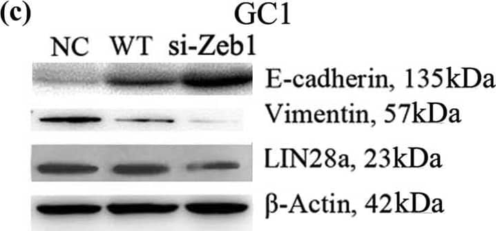 ZEB1 Antibody