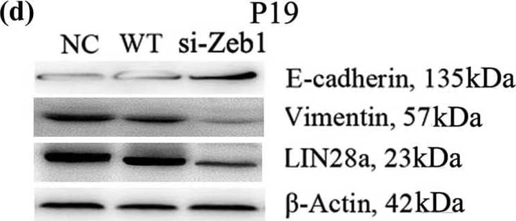 ZEB1 Antibody