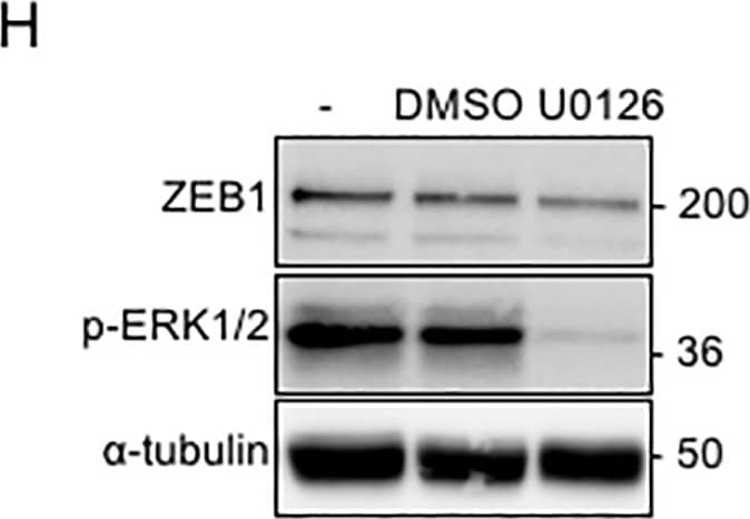 ZEB1 Antibody