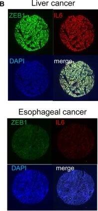 ZEB1 Antibody