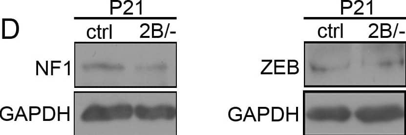 ZEB1 Antibody
