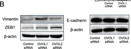 ZEB1 Antibody