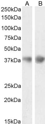 Clusterin/APOJ Antibody