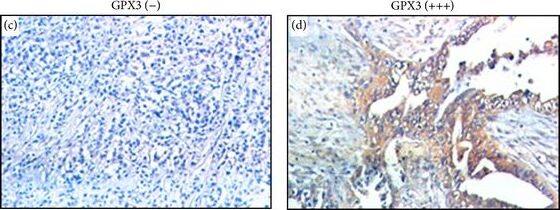 Glutathione Peroxidase 3/GPX3 Antibody