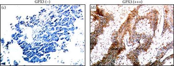 Glutathione Peroxidase 3/GPX3 Antibody