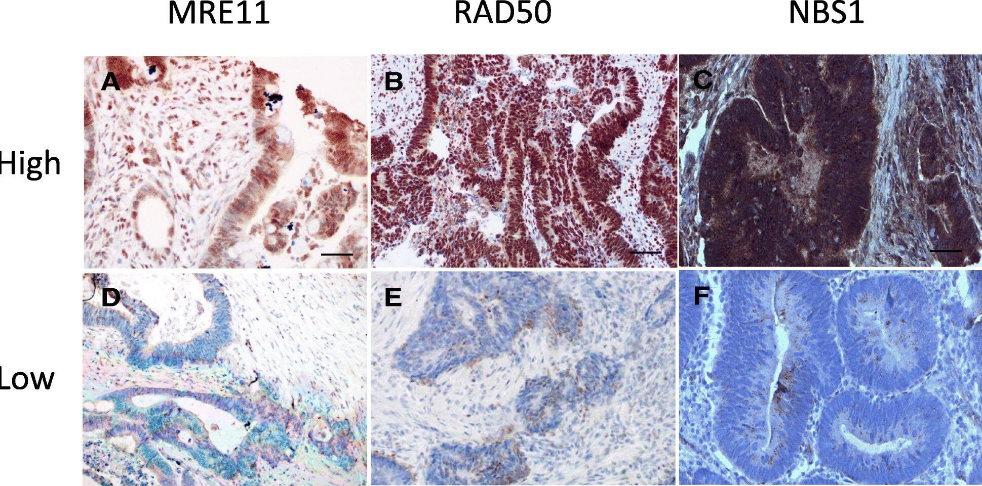 Nbs1 Antibody - BSA Free