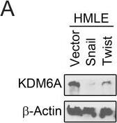 Lysine (K)-specific Demethylase 6B/KDM6B/JMJD3 Antibody - BSA Free