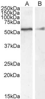 Desmin Antibody
