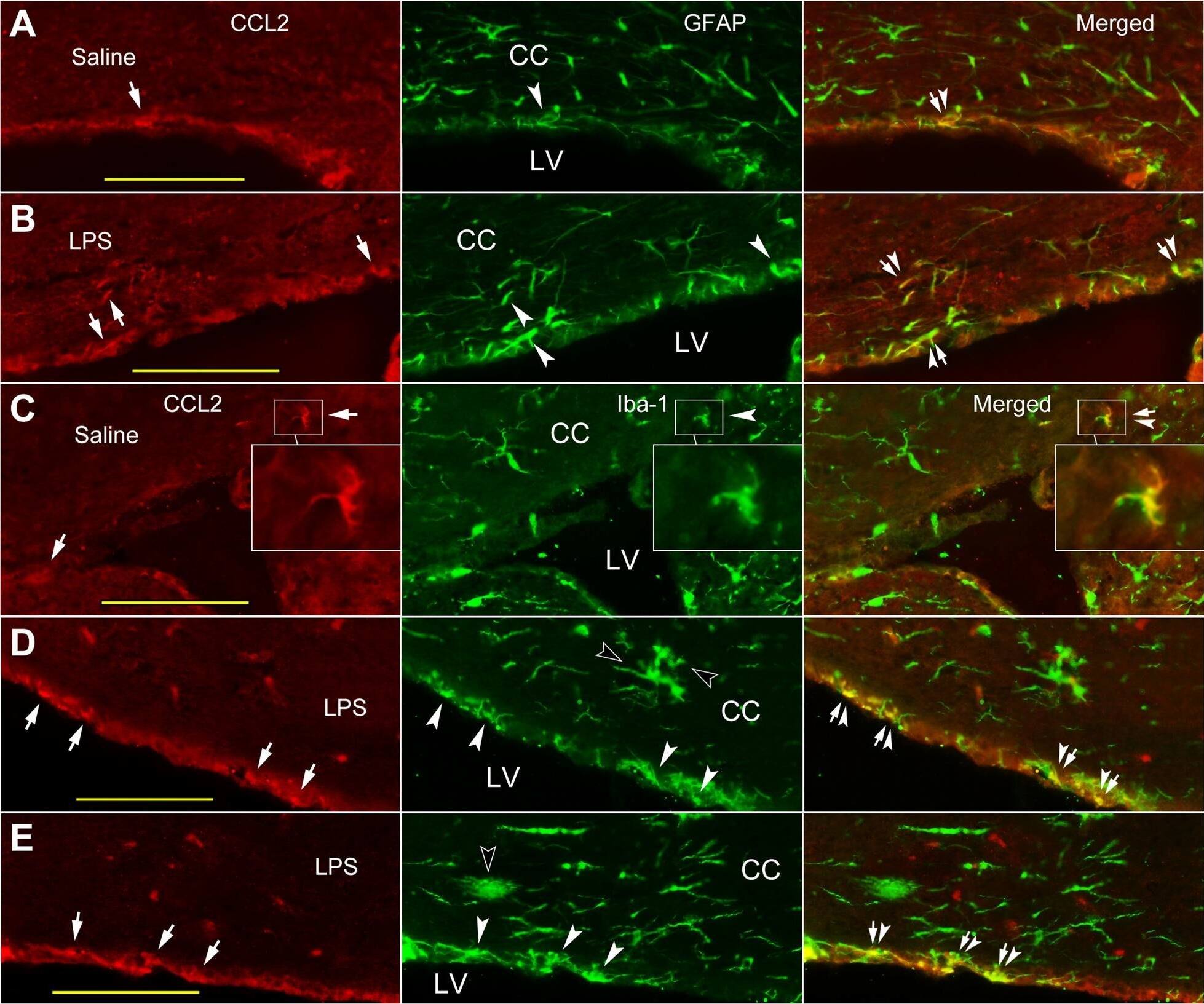 CCL2/MCP1 Antibody - BSA Free