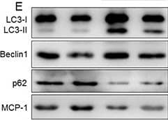 CCL2/MCP1 Antibody - BSA Free