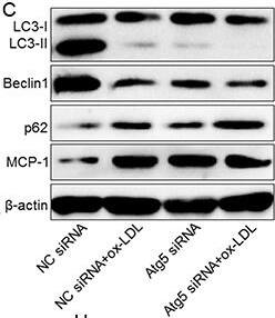 CCL2/MCP1 Antibody - BSA Free
