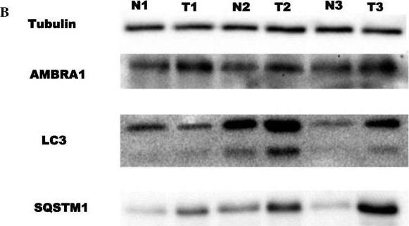 AMBRA1 Antibody - BSA Free